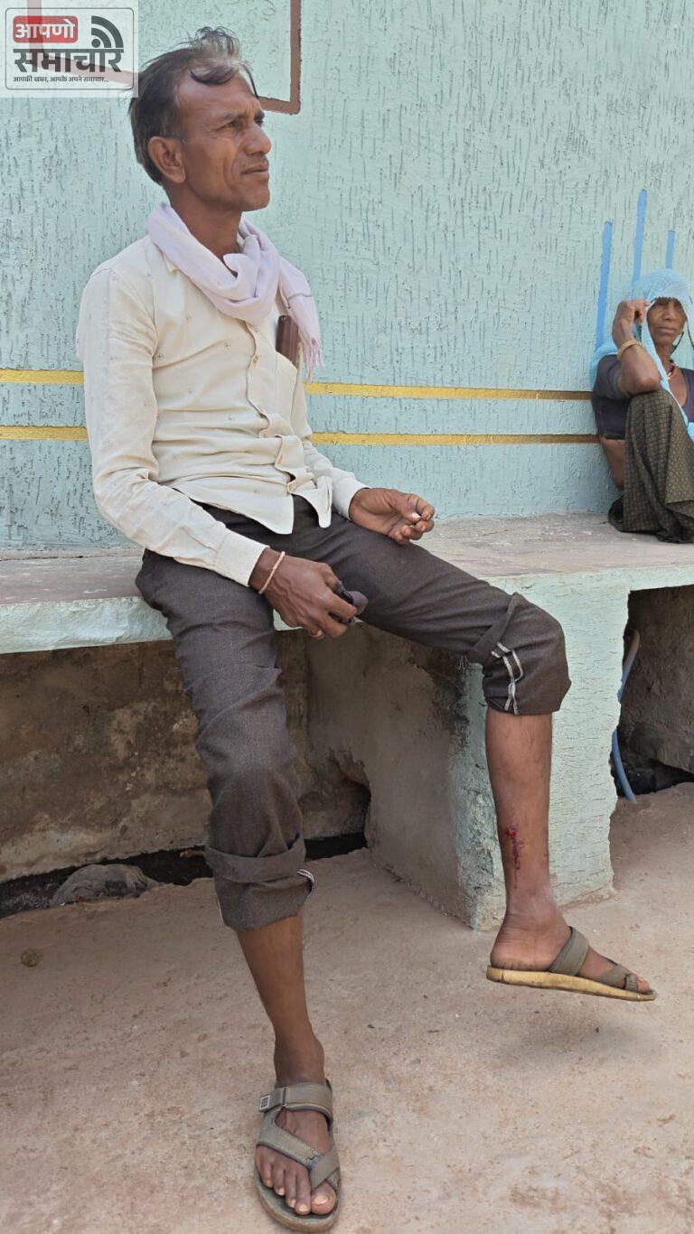 नन्दवाई गांव में कुत्ते का आतंक 8 लोगों को बुरी तरह काटा।